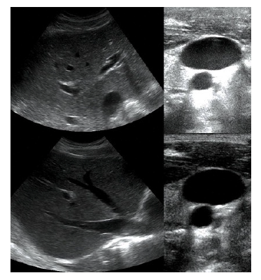 Ultrasound Depth and Gain